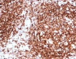 HLA DQ/DR/DP Mouse anti-Human, Clone: HLA-Pan/6663, Novus Biologicals 100